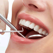 Dental Crown Mississauga